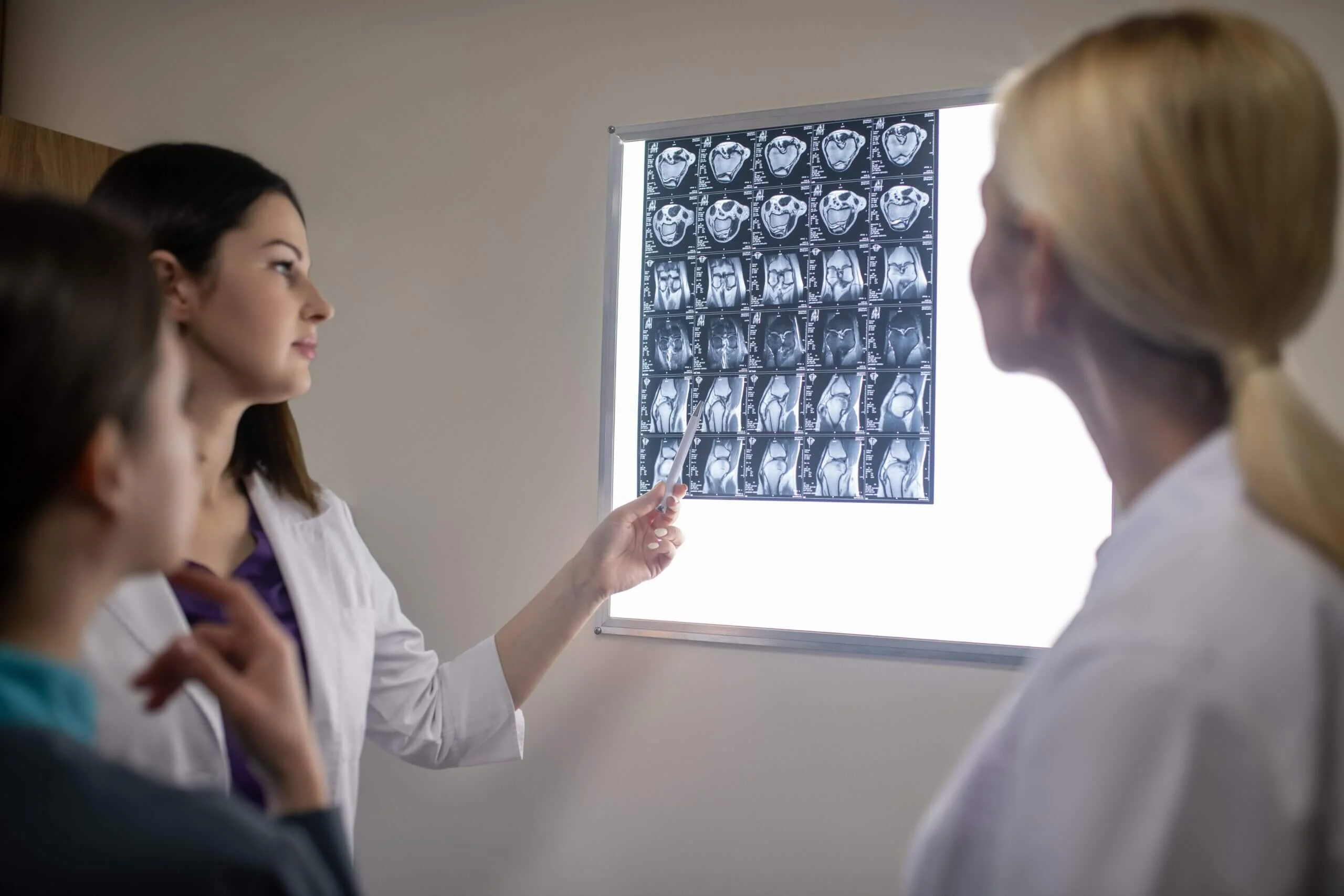 Doctors in Neurological clinic discussing MRI